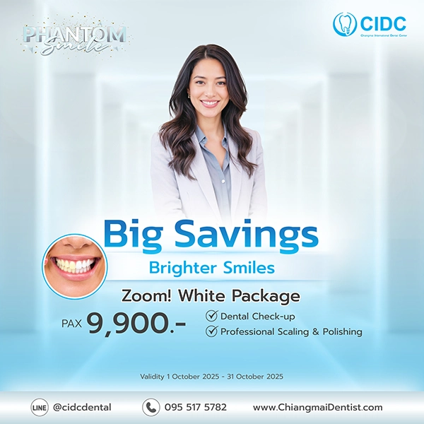 promotion Whitening Teeth