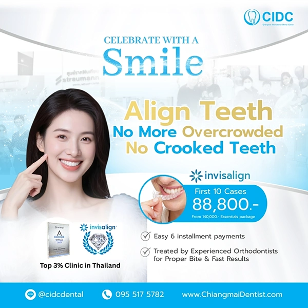 promotion Invisalign