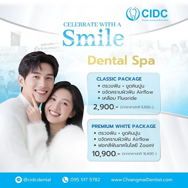 โปรโมชั่นสปาฟันขาว เชียงใหม่