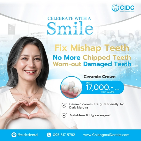 promotion dental crowns