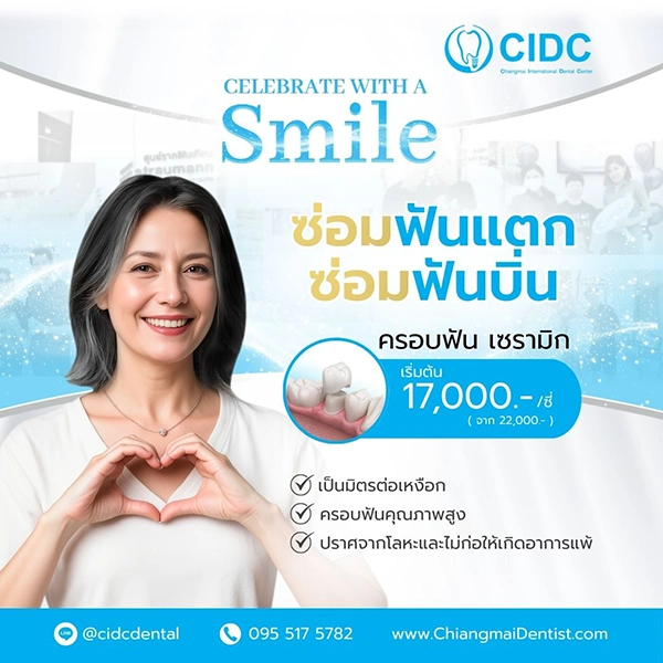 ครอบฟัน ราคา เชียงใหม่