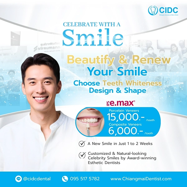 promotion dental veneer