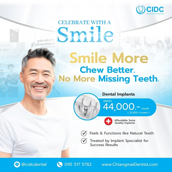 promotion dental implant