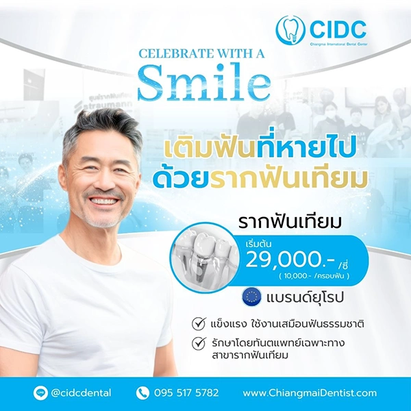 ราคารากฟันเทียม 2568