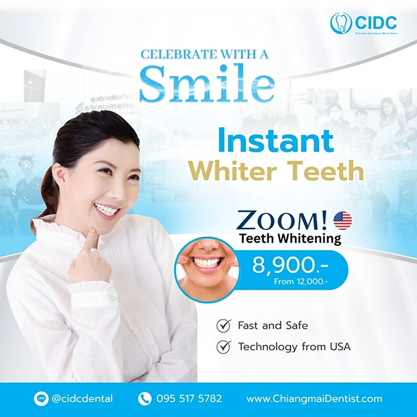 promotion Whitening Teeth