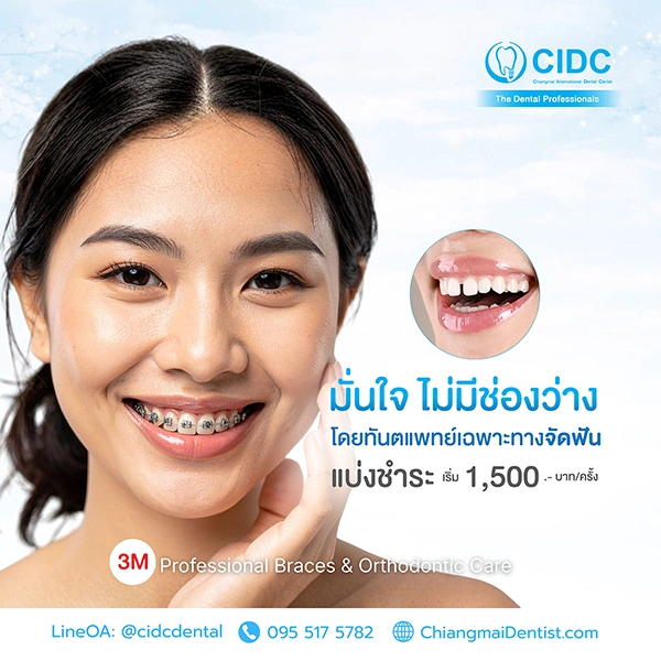 โปรโมชั่นทำฟัน เชียงใหม่