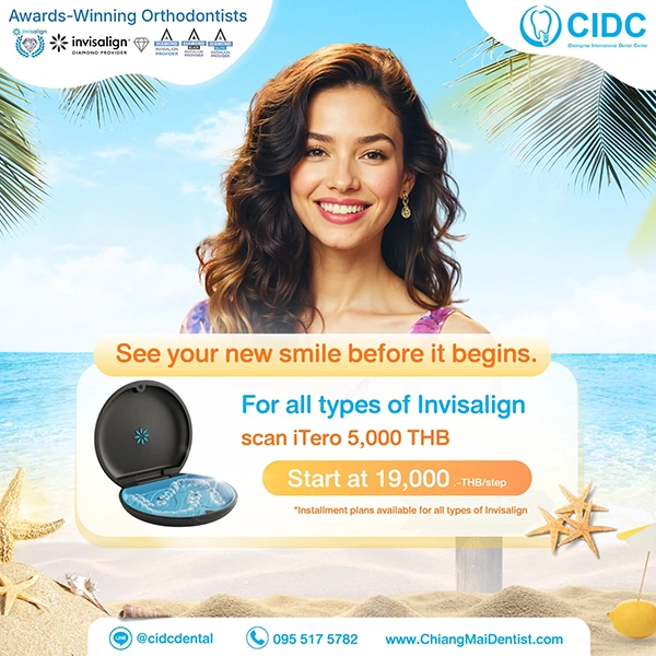 promotion Invisalign