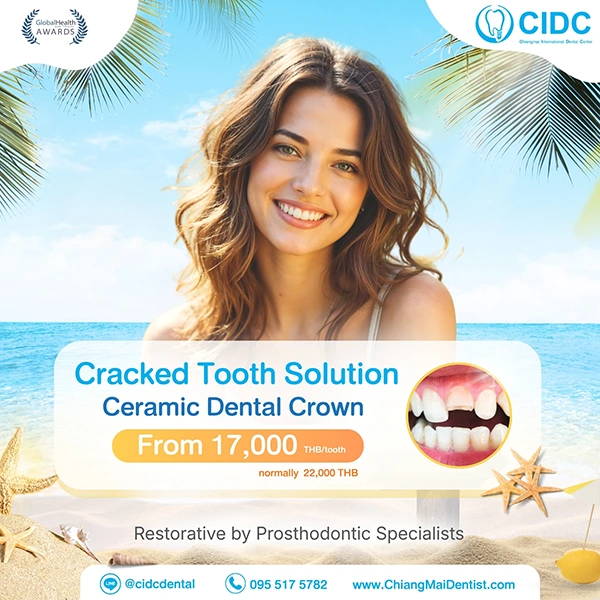 promotion chiangmai dental crowns