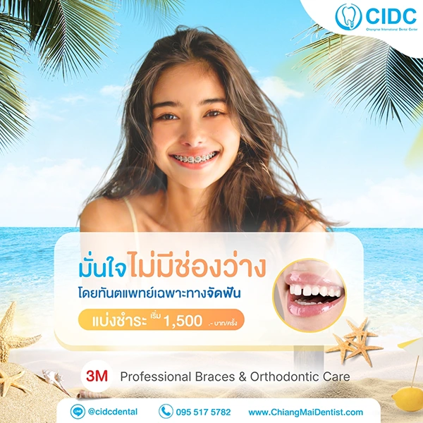 จัดฟันโลหะ ราคา