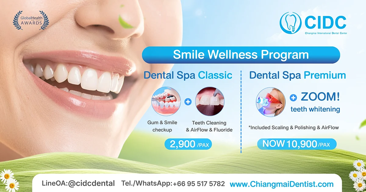 โปรโมชั่นสปาฟันขาว เชียงใหม่