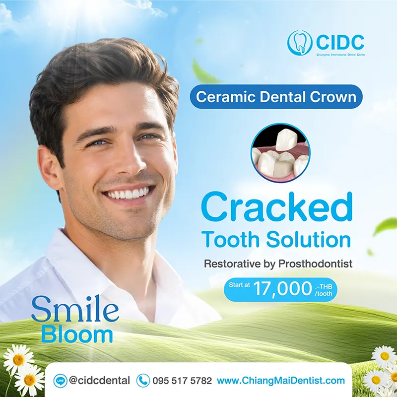 promotion chiangmai dental crowns