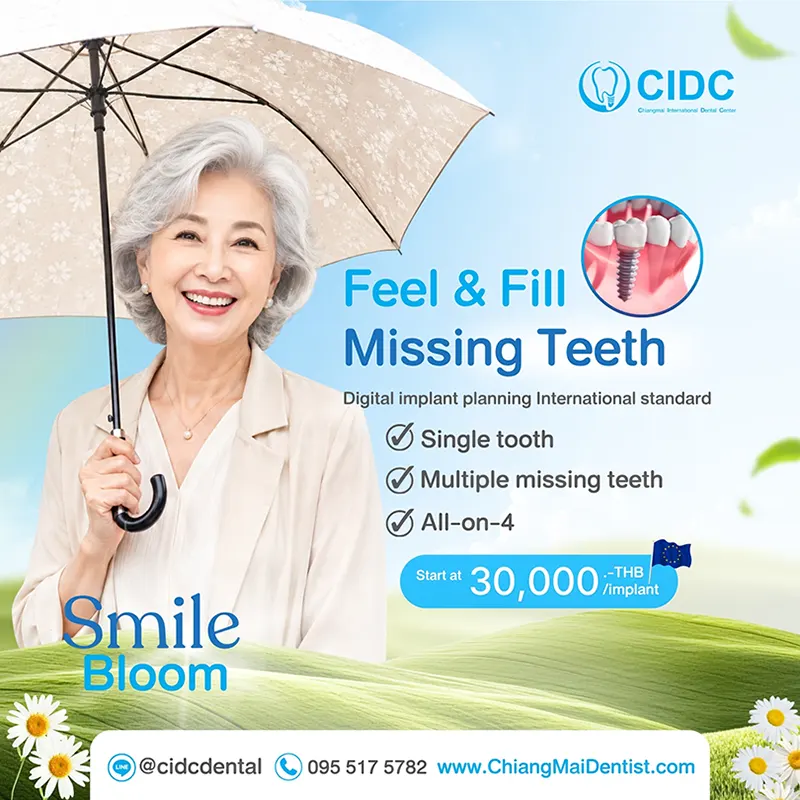 promotion dental implant