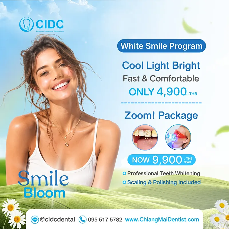 promotion Whitening Teeth