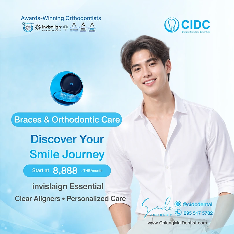 promotion Invisalign
