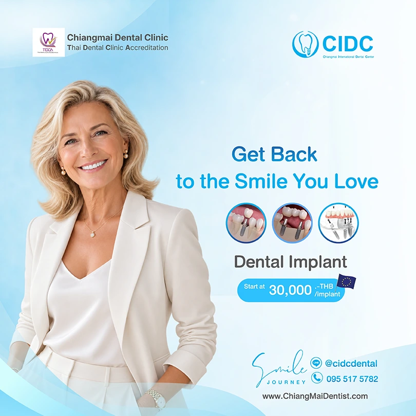 promotion dental implant
